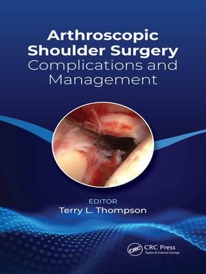 cover image of Arthroscopic Shoulder Surgery